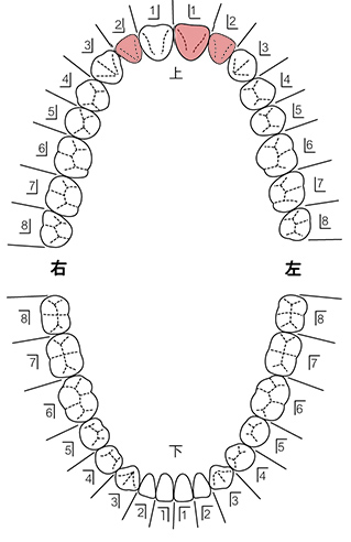 歯式