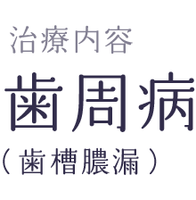 歯周病治療の流れ