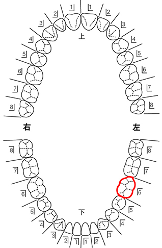 歯式