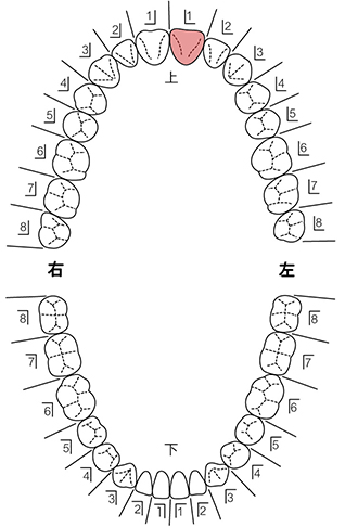 歯式