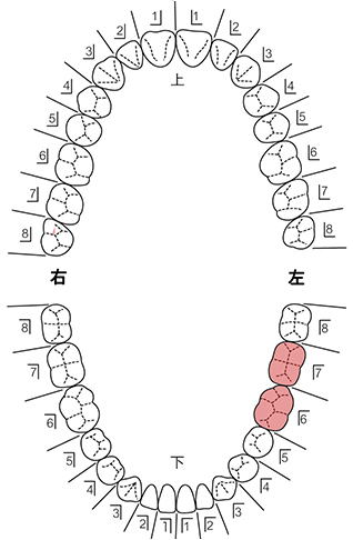 歯式