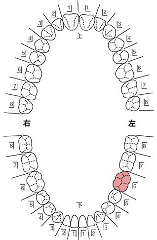 歯式