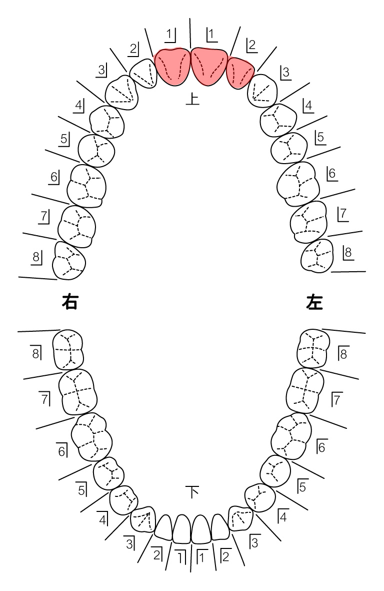 歯式