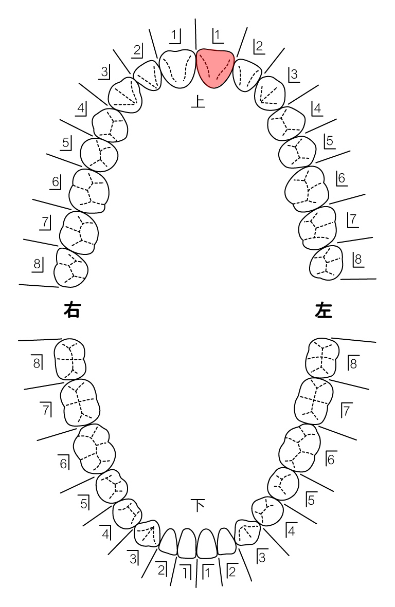 歯式