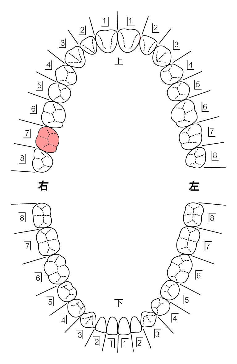 歯式