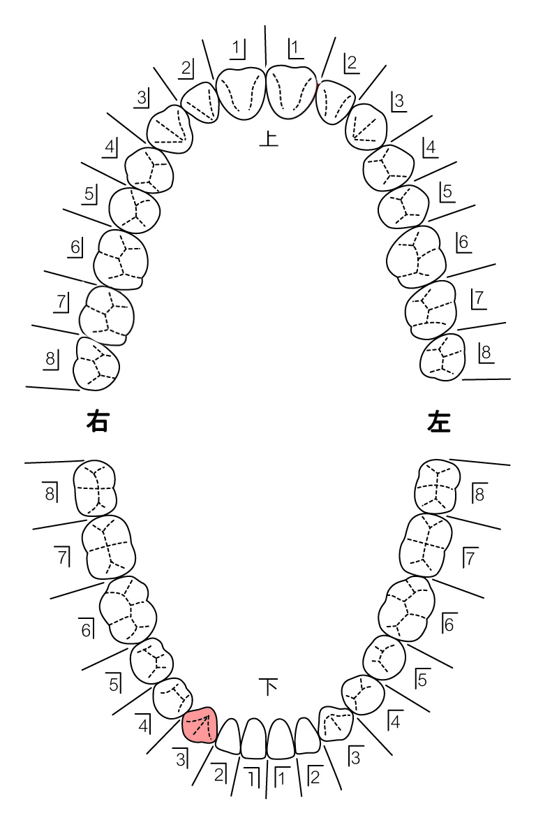 歯式